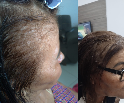 Antes e depois 4